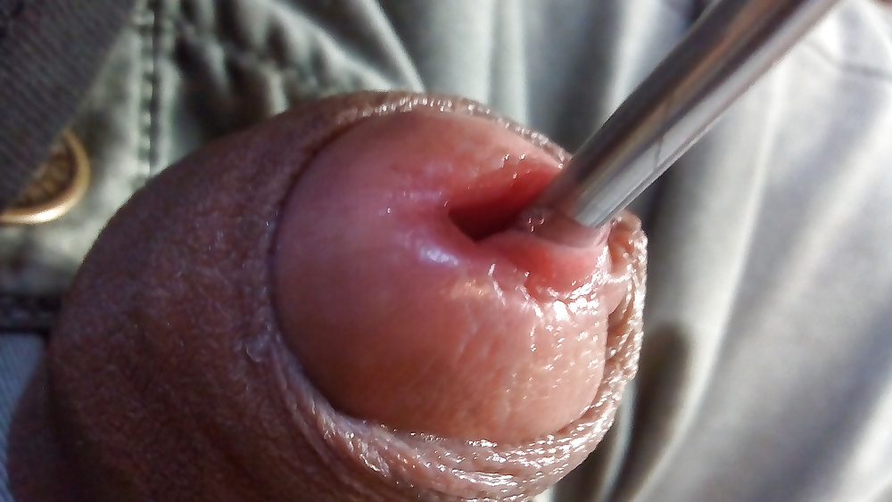 Insertion on urethra (31/71)