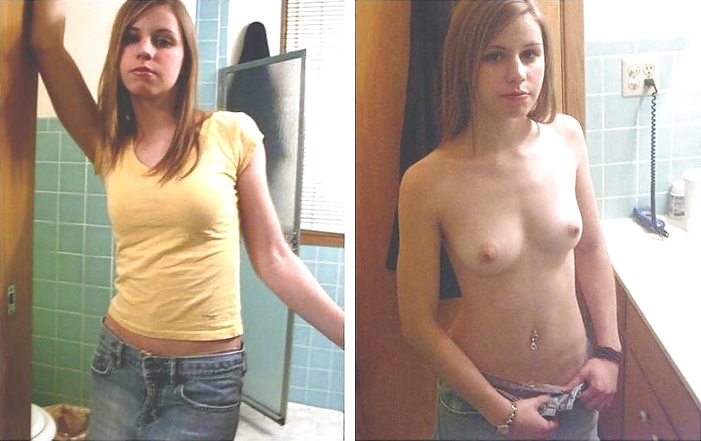Before - After Teen #1 (3/9)