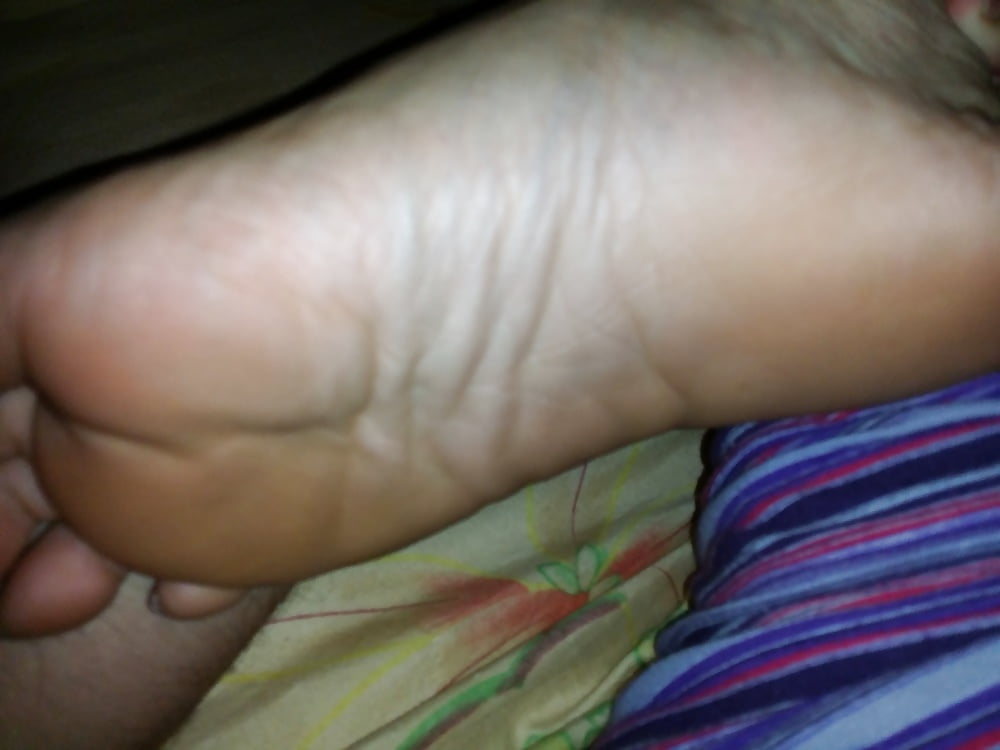 Ex GF ugly feet (10/10)