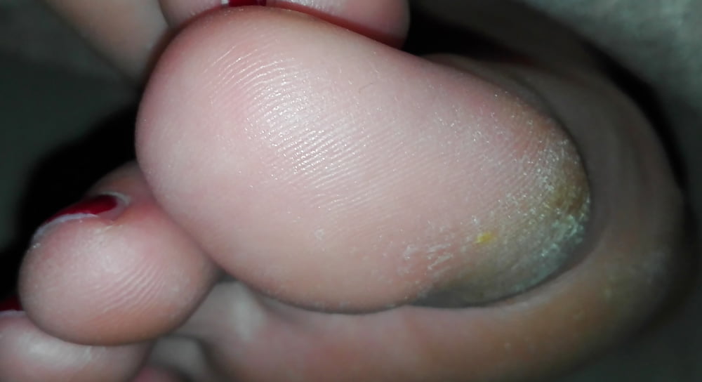 My Wifes Smelly Rough Feet 3 (4/20)