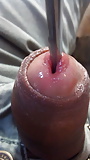 Insertion on urethra (36/71)