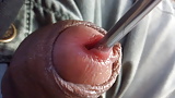 Insertion on urethra (32/71)