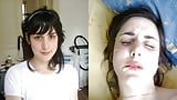 Amateur_before_and_after_facial_collection_2 (10/16)