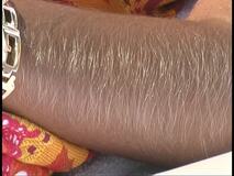 Hairy_Arms_Lori_Anderson (15/21)