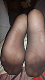 Soles_and_toes (2/9)