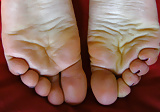 Young_PAWG_Swelled_Feet _Toes _Soles (7/11)