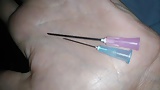 Needles 1 (4)