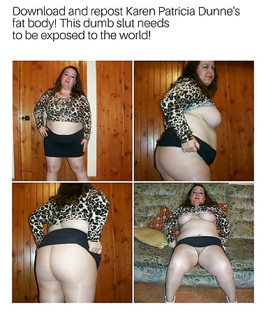 Exposed_Fat_Slut_Karen_Patricia_Dunne_ (1/16)
