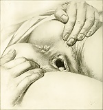Beautiful medical illustrations (14)