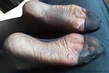 Lyn's wrinkly soles, hosed. (2)
