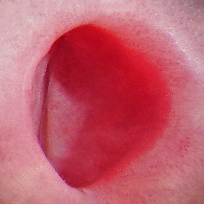 Looking directly inside my pee hole (1/1)