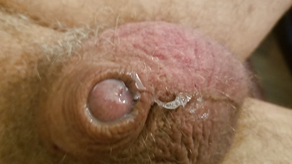 My impotent inverted micro penis (11/13)