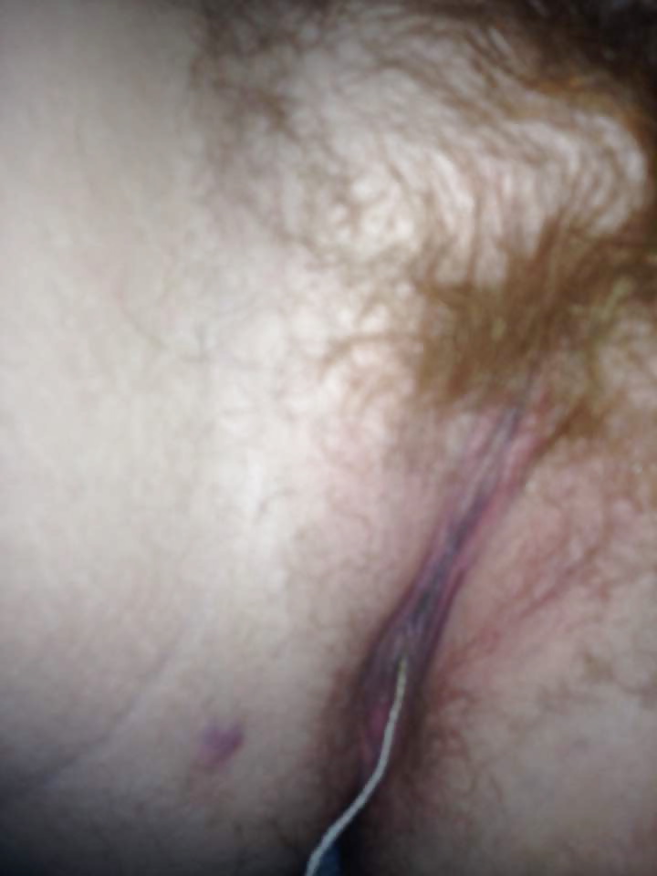 Ugly_Ginger_Pussy (8/10)