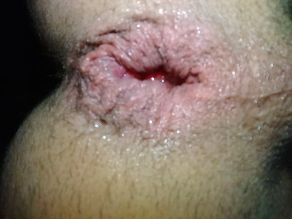 Gaping man pussy open anal hole gapped butthole gape (1/35)