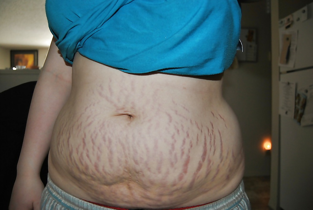 BBW s_with_cellulites_and_stretch_marks_3 (2/38)