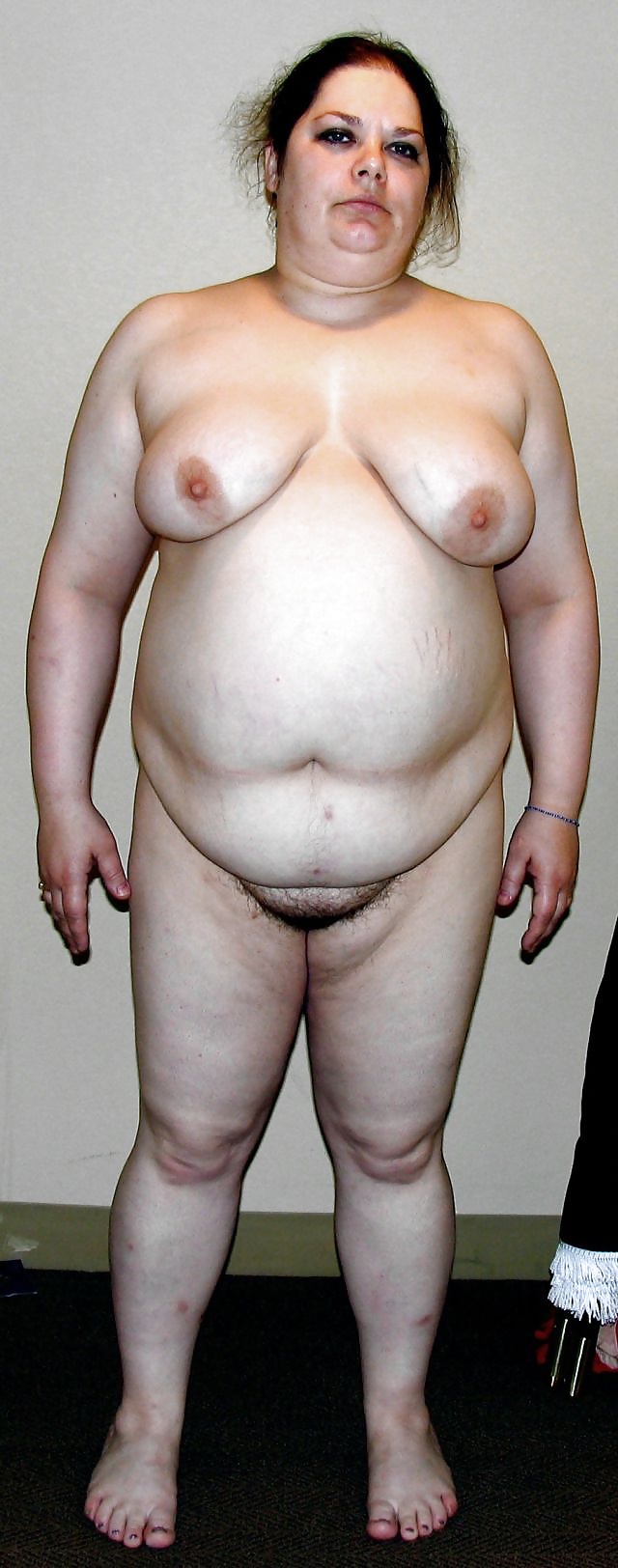 Lydia Bersot Fat Ugly but Fuckable Sex Pic Hd