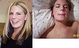 Amateur_before_and_after_facial_collection_2 (7/16)