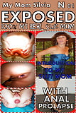 My Real Mom Exposed 01 - Anal Prolapse (2)
