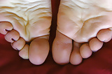 Young_PAWG_Swelled_Feet _Toes _Soles (5/11)