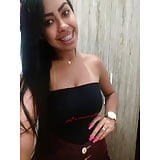 Ysa_Oliveira_ teen_with_brace  (18/50)